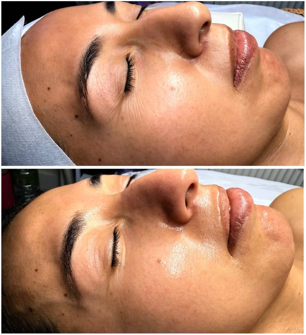 Facial results San Diego esthetician